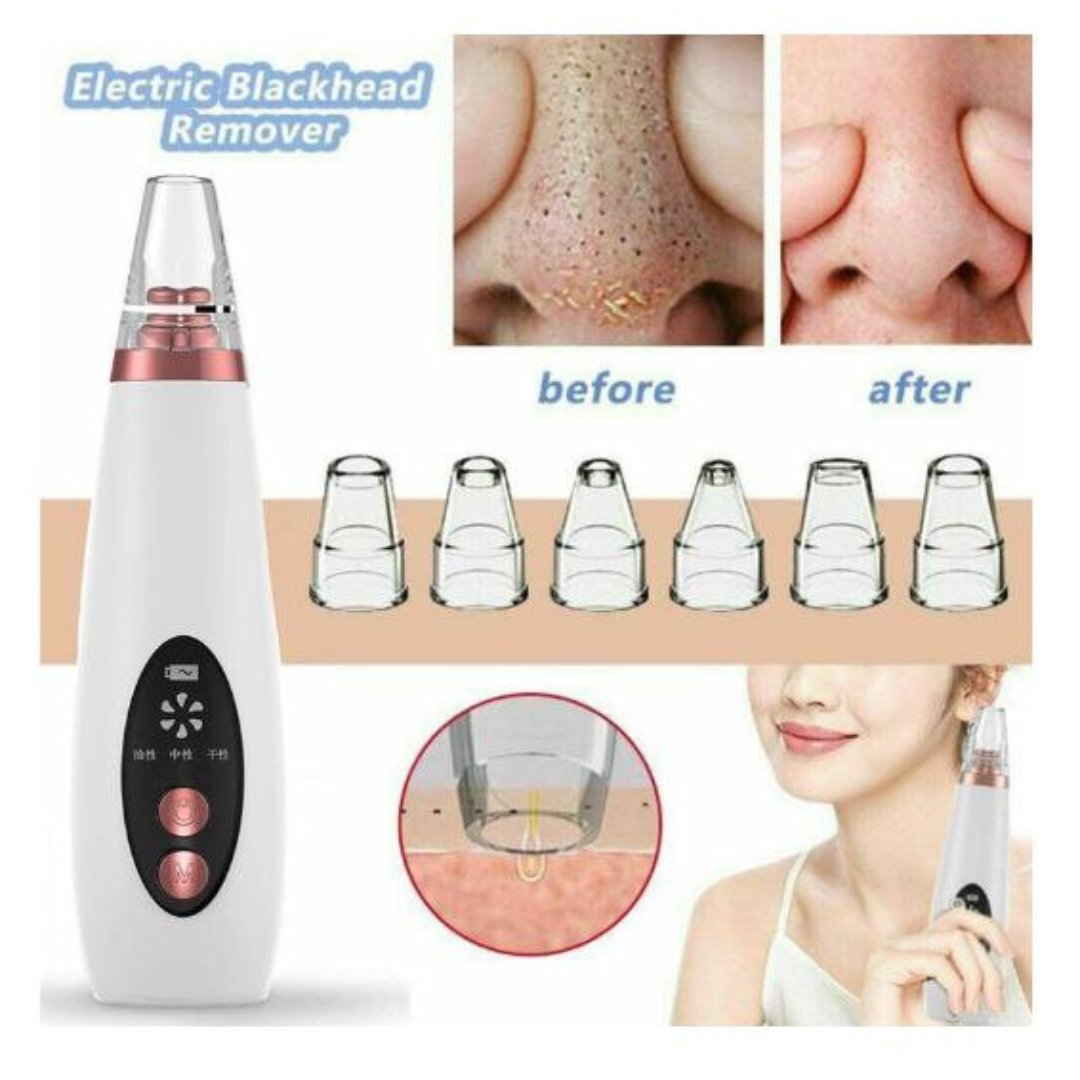 Multifunctional Cleaning Blackhead Remover Device - Image 3