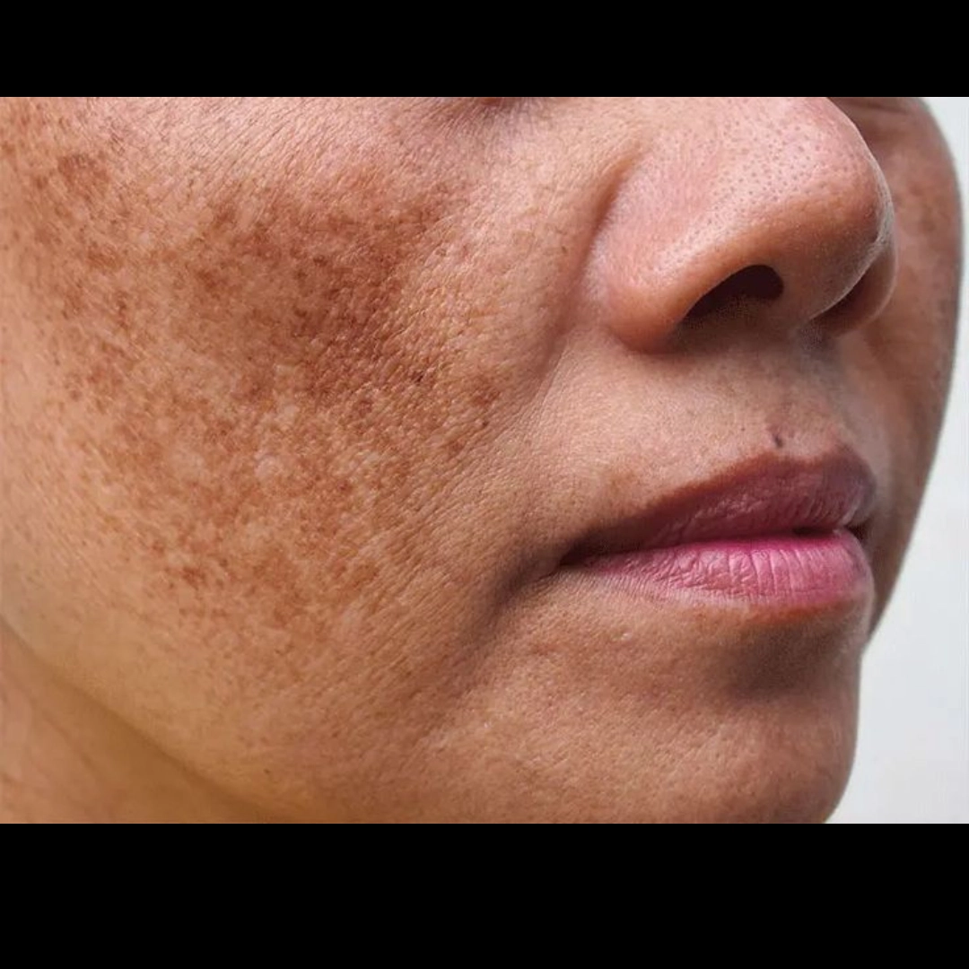 Dr. Althea 345 Relief Cream Dark Spot Face Photo